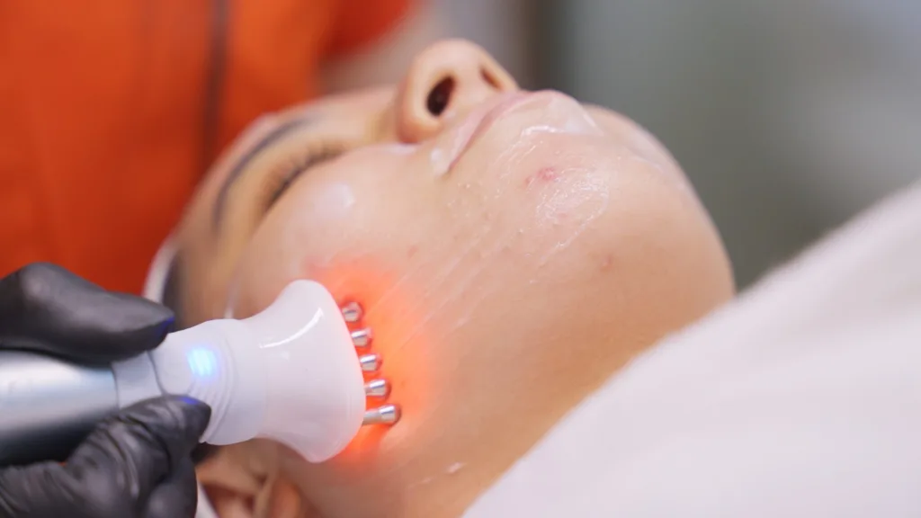 Soin du visage par radiofréquence et lumière LED au centre Epilfit